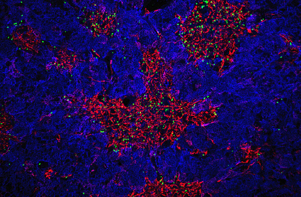 Figure 1: Developing regulatory T cells...